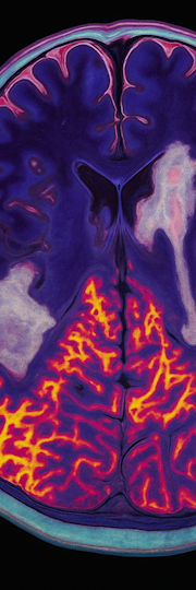 MRI brain slice – decorative artwork